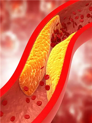 कोलेस्टेरॉल नियंत्रणात राहावे तर, करा फक्त ५ गोष्टी - Marathi News | कोलेस्टेरॉल नियंत्रणात राहावे तर, करा फक्त ५ गोष्टी | Latest Photos at Lokmat.com कोलेस्टेरॉल नियंत्रणात राहावे तर, करा फक्त ५ गोष्टी - Marathi News | कोलेस्टेरॉल नियंत्रणात राहावे तर, करा फक्त ५ गोष्टी | Latest Photos at Lokmat.com